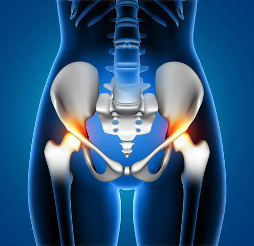 Hip replacement surgery cost in india (5) display